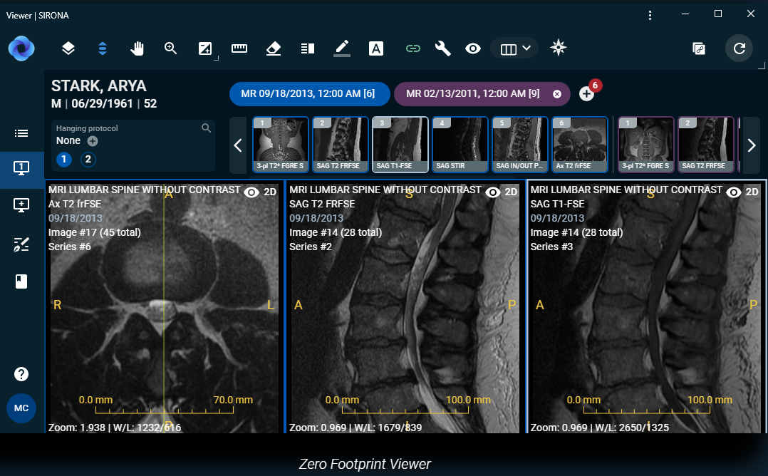 Sirona Medical Acquires Nines Radiology AI Division
