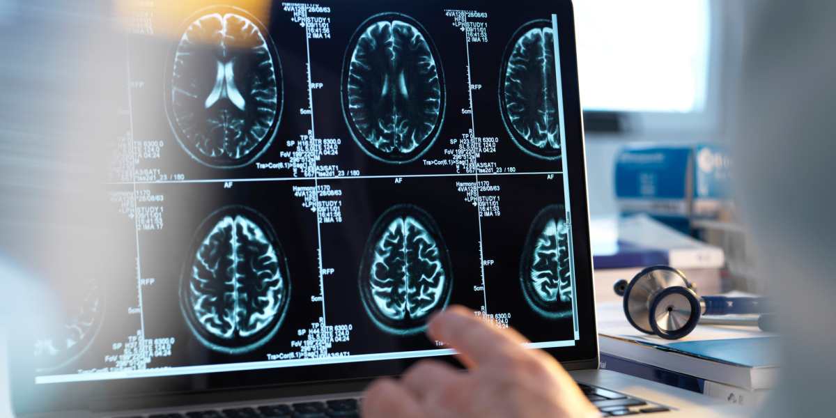 Microsoft Quantum Algorithm Boosts Medical Imaging|Medigy