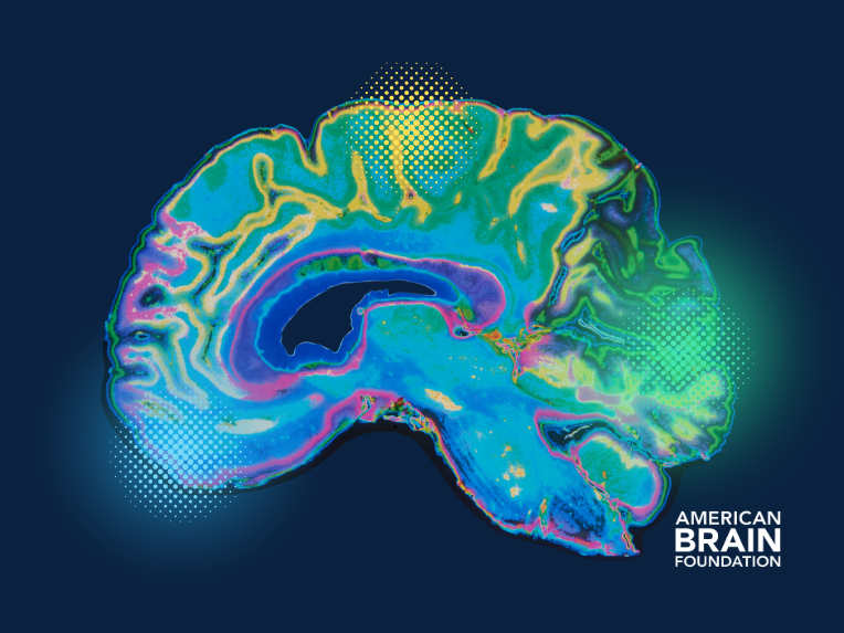 American Brain Foundation Launches $10M Neuroinflammation Research Initiative