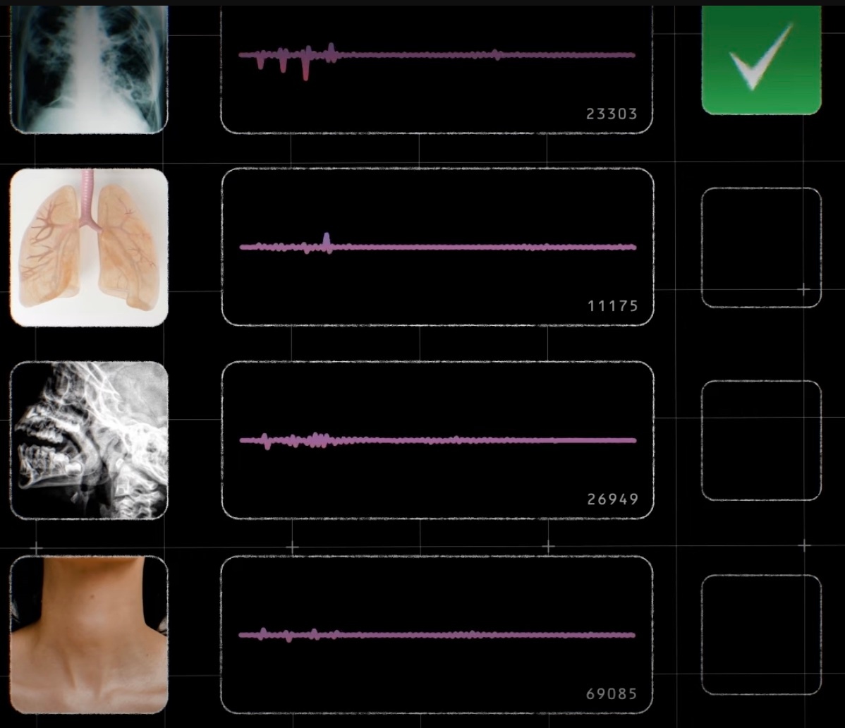 Google's AI Model Listens to Your Cough to Detect Disease