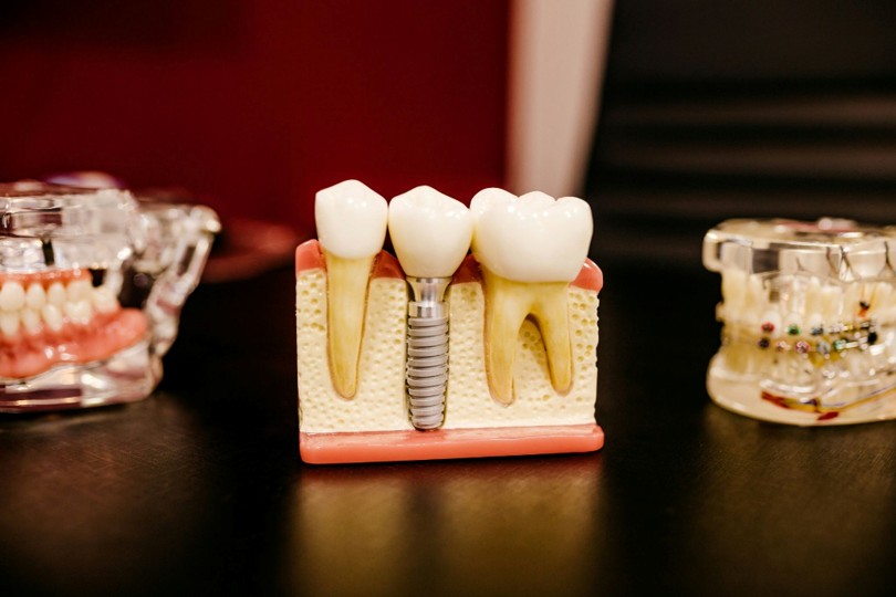 How Digital Innovation Is Improving Restorative Dentistry for Damaged Teeth