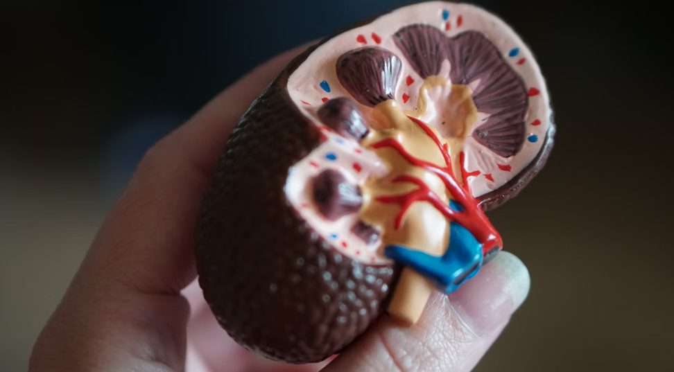 Doctors Share New Research and Insights on Improving Kidney Health