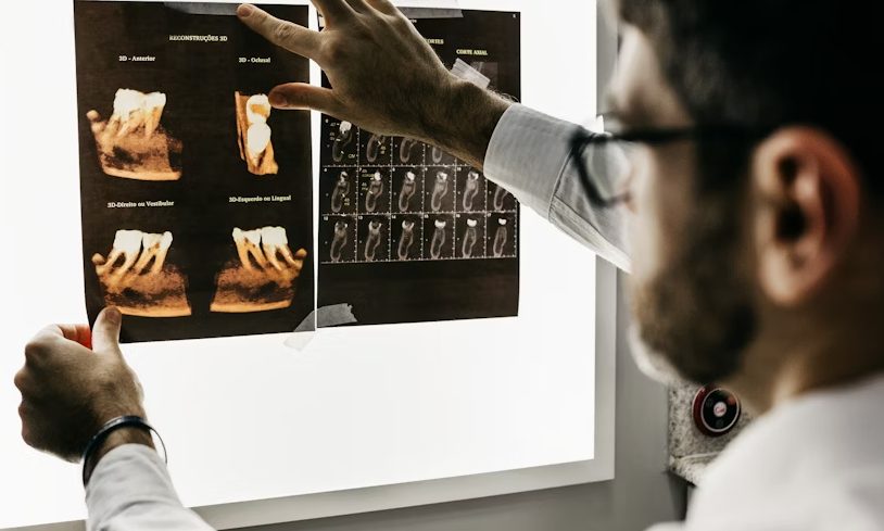 Budgeting a New Tooth: Realistic Ways Families Finance a Dental Implant